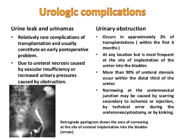 infectious complications of kidney transplantation Urinary tract infection (uti) is the most common infectious complication in kidney transplant recipients with a reported incidence from 25% to 75%, varies widely. infectious complications of kidney transplantation Urinary tract infection (uti) is the most common infectious complication in kidney transplant recipients with a reported incidence from 25% to 75%, varies widely.