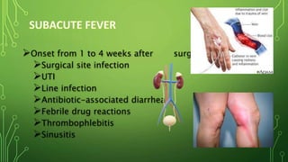 POST OPERATIVE FEVER.pptx