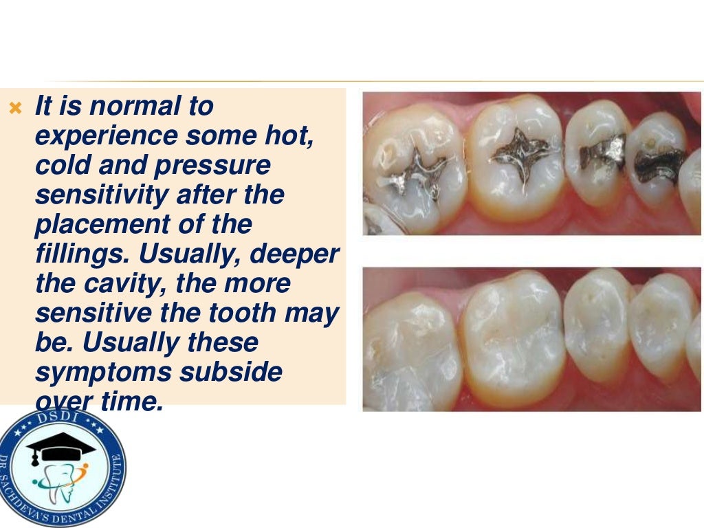 Post operative instructions after Dental Fillings