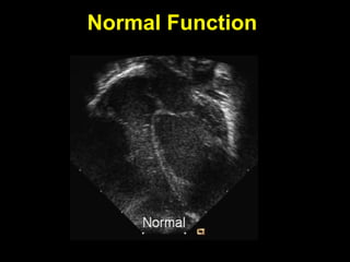 Post Operative Management