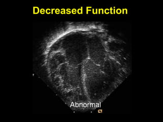 Post Operative Management