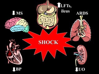 Post Operative Management