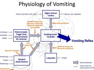 Dealing With Post Op Vomiting Reference: Post Operative Nausea And Vomiting 2 Pptx