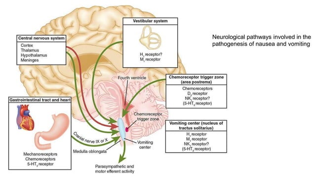 Curated visual reference: Post Operative Nausea And Vomiting Pptx Photo Inspiration