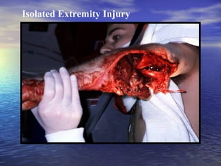 Isolated Extremity Injury

 