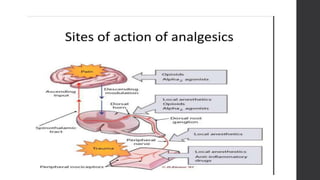 Postoperative pain management   