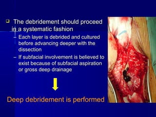  TThhee ddeebbrriiddeemmeenntt sshhoouulldd pprroocceeeedd 
iinn aa ssyysstteemmaattiicc ffaasshhiioonn 
– EEaacchh llaayyeerr iiss ddeebbrriiddeedd aanndd ccuullttuurreedd 
bbeeffoorree aaddvvaanncciinngg ddeeeeppeerr wwiitthh tthhee 
ddiisssseeccttiioonn 
– IIff ssuubbffaacciiaall iinnvvoollvveemmeenntt iiss bbeelliieevveedd ttoo 
eexxiisstt bbeeccaauussee ooff ssuubbffaacciiaall aassppiirraattiioonn 
oorr ggrroossss ddeeeepp ddrraaiinnaaggee 
Deep debridement is performed 
 