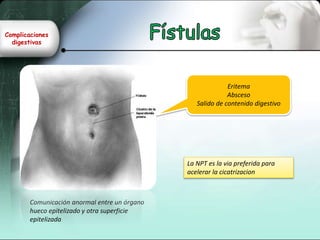 Complicaciones
digestivas
Comunicación anormal entre un órgano
hueco epitelizado y otra superficie
epitelizada
Eritema
Absceso
Salido de contenido digestivo
La NPT es la via preferida para
acelerar la cicatrizacion
 