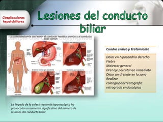 Complicaciones
hepatobiliares
La llegada de la colecistectomía laparoscópica ha
provocado un aumento significativo del número de
lesiones del conducto biliar
Cuadro clínico y Tratamiento
Dolor en hipocondrio derecho
Fiebre
Malestar general
Drenaje percutaneo inmediato
Dejar un drenaje en la zona
Realizar
colangiopancreatografia
retrograda endoscópica
 