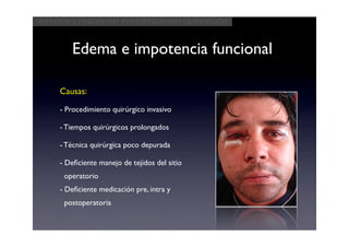 Aspectos clínicos del postoperatorio quirúrgico



        Edema e impotencia funcional

     Causas:
     - Procedimiento quirúrgico invasivo

     - Tiempos quirúrgicos prolongados

     - Técnica quirúrgica poco depurada

     - Deﬁciente manejo de tejidos del sitio
      operatorio
     - Deﬁciente medicación pre, intra y
      postoperatoria
 