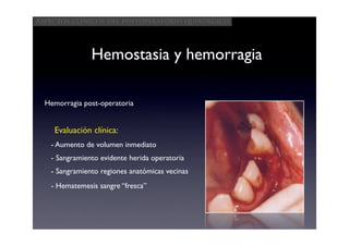 Aspectos clínicos del postoperatorio quirúrgico




               Hemostasia y hemorragia

  Hemorragia post-operatoria


    Evaluación clínica:
   - Aumento de volumen inmediato
   - Sangramiento evidente herida operatoria
   - Sangramiento regiones anatómicas vecinas
   - Hematemesis sangre “fresca”
 