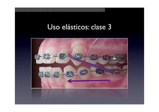 Aspectos clínicos del postoperatorio quirúrgico




                Uso elásticos: clase 3
 