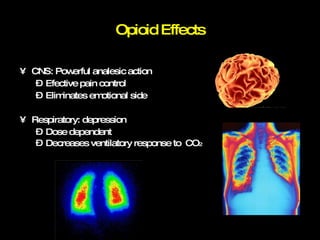 Opioid Effects CNS: Powerful analesic action Efective pain control Eliminates emotional side Respiratory: depression Dose dependent Decreases ventilatory response to  CO 2 