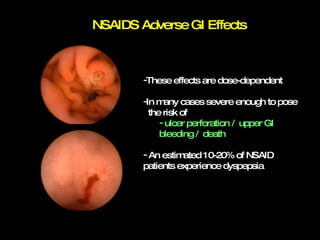 NSAIDS Adverse GI Effects These effects are dose-dependent In many cases severe enough to pose  the risk of  ulcer perforation /  upper GI bleeding /  death An estimated 10-20% of NSAID patients experience dyspepsia 