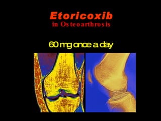 in Osteoarthrosis 60 mg once a day Etoricoxib 