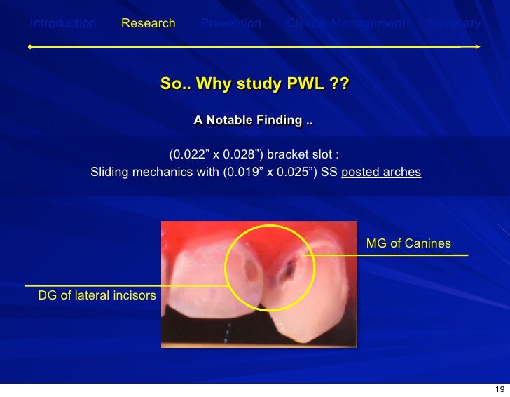 Post Orthodontic Demineralization for Prevention and…