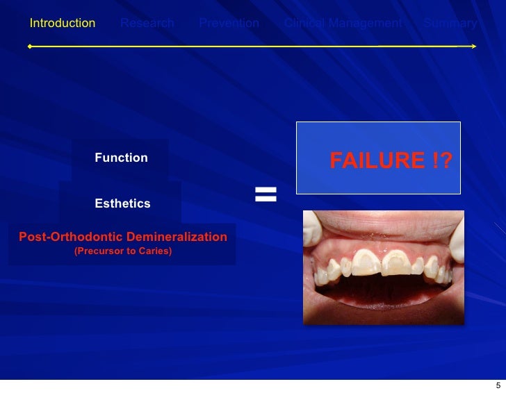 Post Orthodontic Demineralization for Prevention and…