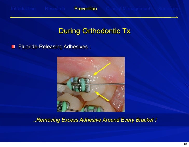 Post Orthodontic Demineralization for Prevention and…