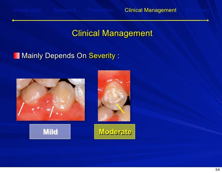 Post Orthodontic Demineralization for Prevention and…