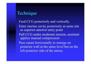 Technique
Feed CCG posteriorly and vertically.
Enter uterine cavity posteriorly at same site
as superior anterior entry point
Pull CCG under moderate tension, assistant
applies manual compression
Pass suture horizontally to emerge on
posterior wall at the same level but on the
left posterior side of the uterus
 