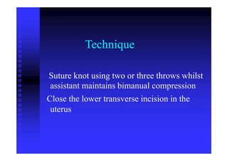 Technique
Suture knot using two or three throws whilst
assistant maintains bimanual compression
Close the lower transverse incision in the
uterus
 