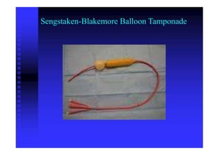 Sengstaken-Blakemore Balloon Tamponade
 