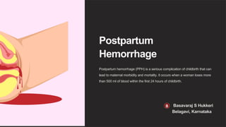 Postpartum
Hemorrhage
Postpartum hemorrhage (PPH) is a serious complication of childbirth that can
lead to maternal morbidity and mortality. It occurs when a woman loses more
than 500 ml of blood within the first 24 hours of childbirth.
B Basavaraj S Hukkeri
Belagavi, Karnataka
 