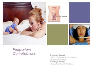 +
Postpartum
Complications Dr. Ahmed Rashad
PGY2 Family Medicine Resident
Under supervision of
Dr. Fathiya Almeer
Consultant Family Medicine
 