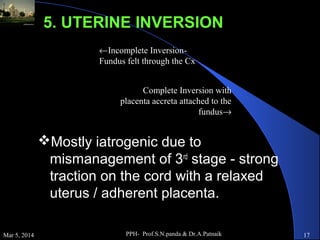 5. UTERINE INVERSION
←Incomplete InversionFundus felt through the Cx
Complete Inversion with
placenta accreta attached to the
fundus→

Mostly iatrogenic due to
mismanagement of 3rd stage - strong
traction on the cord with a relaxed
uterus / adherent placenta.
Mar 5, 2014

PPH- Prof.S.N.panda & Dr.A.Patnaik

17

 