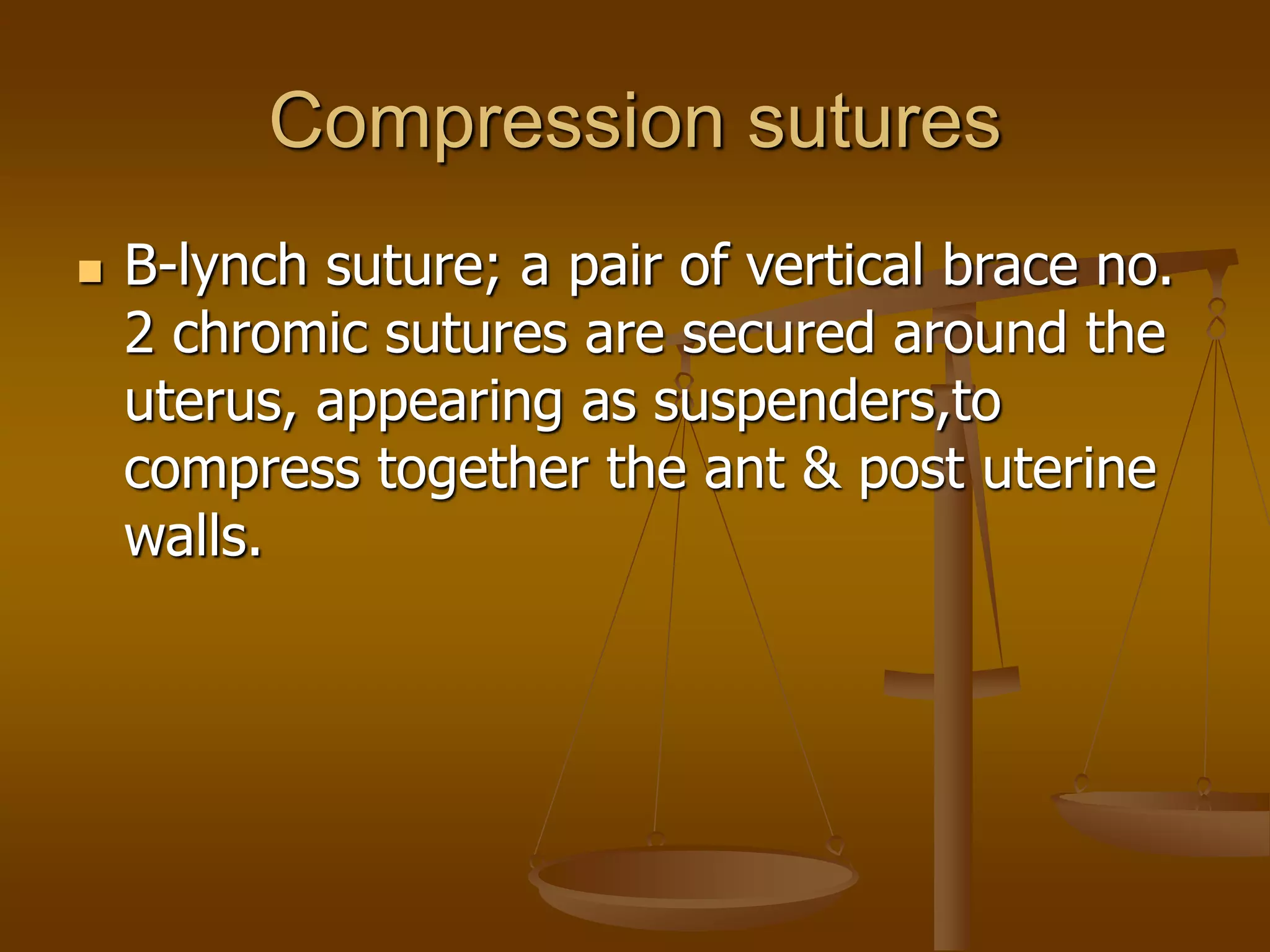 Postpartum haemorrhage.ppt
