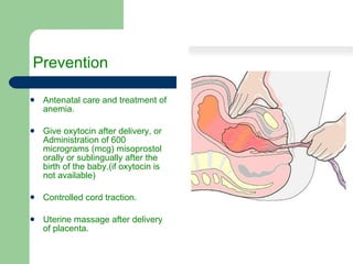 Prevention   Antenatal care and treatment of anemia. Give oxytocin after delivery, or  Administration of 600 micrograms (mcg) misoprostol orally or sublingually after the birth of the baby.(if oxytocin is not available) Controlled cord traction. Uterine massage after delivery of placenta. 