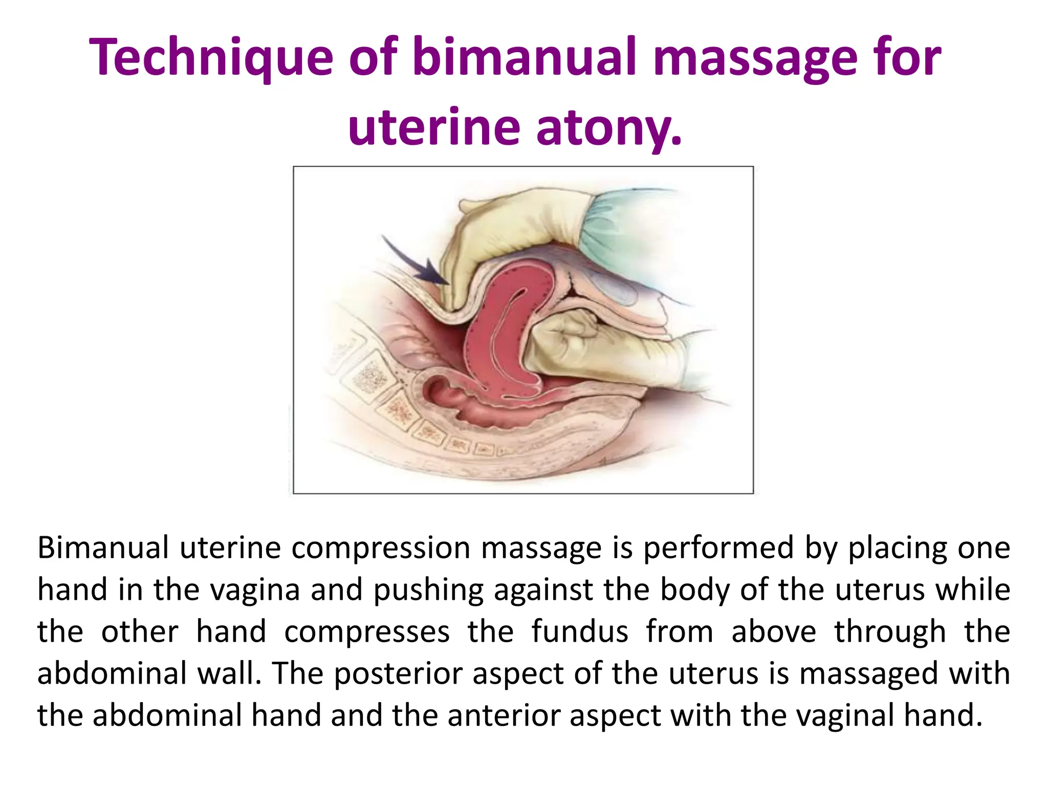 POST PARTUM HAEMORRHAGE PPH pptx post-partum-haemorrhage-pph-pptx