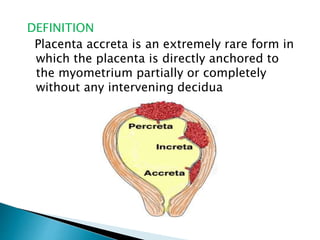 DEFINITION
Placenta accreta is an extremely rare form in
which the placenta is directly anchored to
the myometrium partially or completely
without any intervening decidua
 