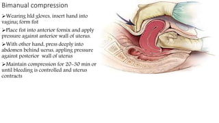 Bimanual compression
Wearing hld gloves, insert hand into
vagina; form fist
Place fist into anterior fornix and apply
pressure against anterior wall of uterus.
With other hand, press deeply into
abdomen behind uerus, appling pressure
against posterior wall of uterus
Maintain compression for 20-30 min or
until bleeding is controlled and uterus
contracts
 