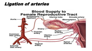 Ligation of arteries
 