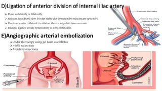 D)Ligation of anterior division of internal iliac artery
 Done unilaterally or bilaterally.
 Reduces distal blood flow. It helps stable clot formation by reducing pp up to 85%.
 Due to extensive collateral circulation, there is no pelvic tissue necrosis.
 Bilateral ligation avoids hysterectomy in 50% of the cases.
E)Angiographic arterial embolization
Under fluroscopy using gel foam as embolus
>90% sucess rate
Avoids hysterectomy
 