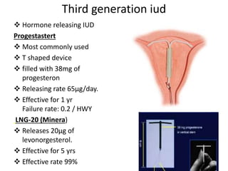 Third generation iud
 Hormone releasing IUD
Progestastert
 Most commonly used
 T shaped device
 filled with 38mg of
progesteron
 Releasing rate 65µg/day.
 Effective for 1 yr
Failure rate: 0.2 / HWY
LNG-20 (Minera)
 Releases 20µg of
levonorgesterol.
 Effective for 5 yrs
 Effective rate 99%
 