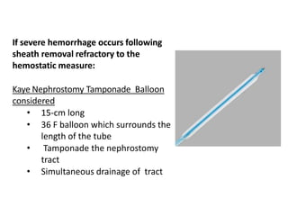 If severe hemorrhage occurs following
sheath removal refractory to the
hemostatic measure:
Kaye Nephrostomy Tamponade Balloon
considered
• 15-cm long
• 36 F balloon which surrounds the
length of the tube
• Tamponade the nephrostomy
tract
• Simultaneous drainage of tract
 