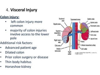4. Visceral Injury
Colon injury:
• left colon injury more
common
• majority of colon injuries
involve access to the lower
pole
Additional risk factors:
• Advanced patient age
• Dilated colon
• Prior colon surgery or disease
• Thin body habitus
• Horseshoe kidney
 
