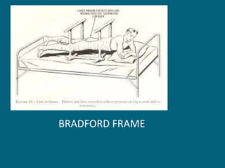 BRADFORD FRAME
 