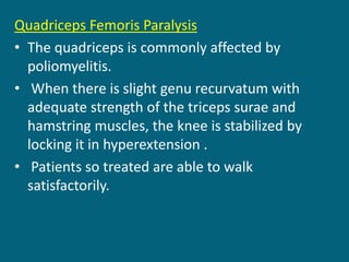 Quadriceps Femoris Paralysis
• The quadriceps is commonly affected by
poliomyelitis.
• When there is slight genu recurvatum with
adequate strength of the triceps surae and
hamstring muscles, the knee is stabilized by
locking it in hyperextension .
• Patients so treated are able to walk
satisfactorily.
 