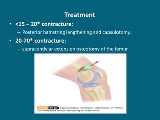 Treatment
• <15 – 20* contracture:
– Posterior hamstring lengthening and capsulotomy.
• 20-70* contracture:
– supracondylar extension osteotomy of the femur
 