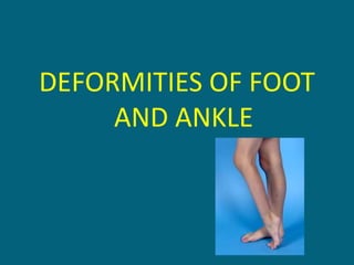 DEFORMITIES OF FOOT
AND ANKLE
 