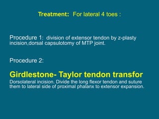 Treatment: For lateral 4 toes :
Procedure 1: division of extensor tendon by z-plasty
incision,dorsal capsulotomy of MTP joint.
Procedure 2:
Girdlestone- Taylor tendon transfor
Dorsolateral incision. Divide the long flexor tendon and suture
them to lateral side of proximal phalanx to extensor expansion.
 