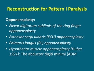 Reconstruction for Pattern I Paralysis
Opponensplasty:
• Flexor digitorum sublimis of the ring finger
opponensplasty
• Extensor carpi ulnaris (ECU) opponensplasty
• Palmaris longus (PL) opponensplasty
• Hypothenar muscle opponensplasty (Huber
1921): The abductor digiti minimi (ADM
 