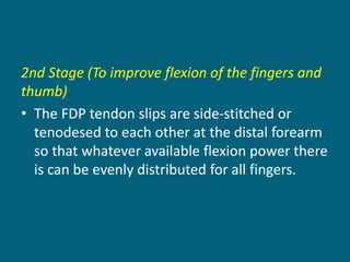 2nd Stage (To improve flexion of the fingers and
thumb)
• The FDP tendon slips are side-stitched or
tenodesed to each other at the distal forearm
so that whatever available flexion power there
is can be evenly distributed for all fingers.
 