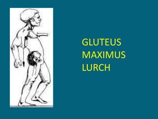 GLUTEUS
MAXIMUS
LURCH
 