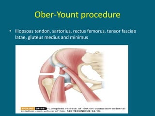 Ober-Yount procedure
• Iliopsoas tendon, sartorius, rectus femorus, tensor fasciae
latae, gluteus medius and minimus
 