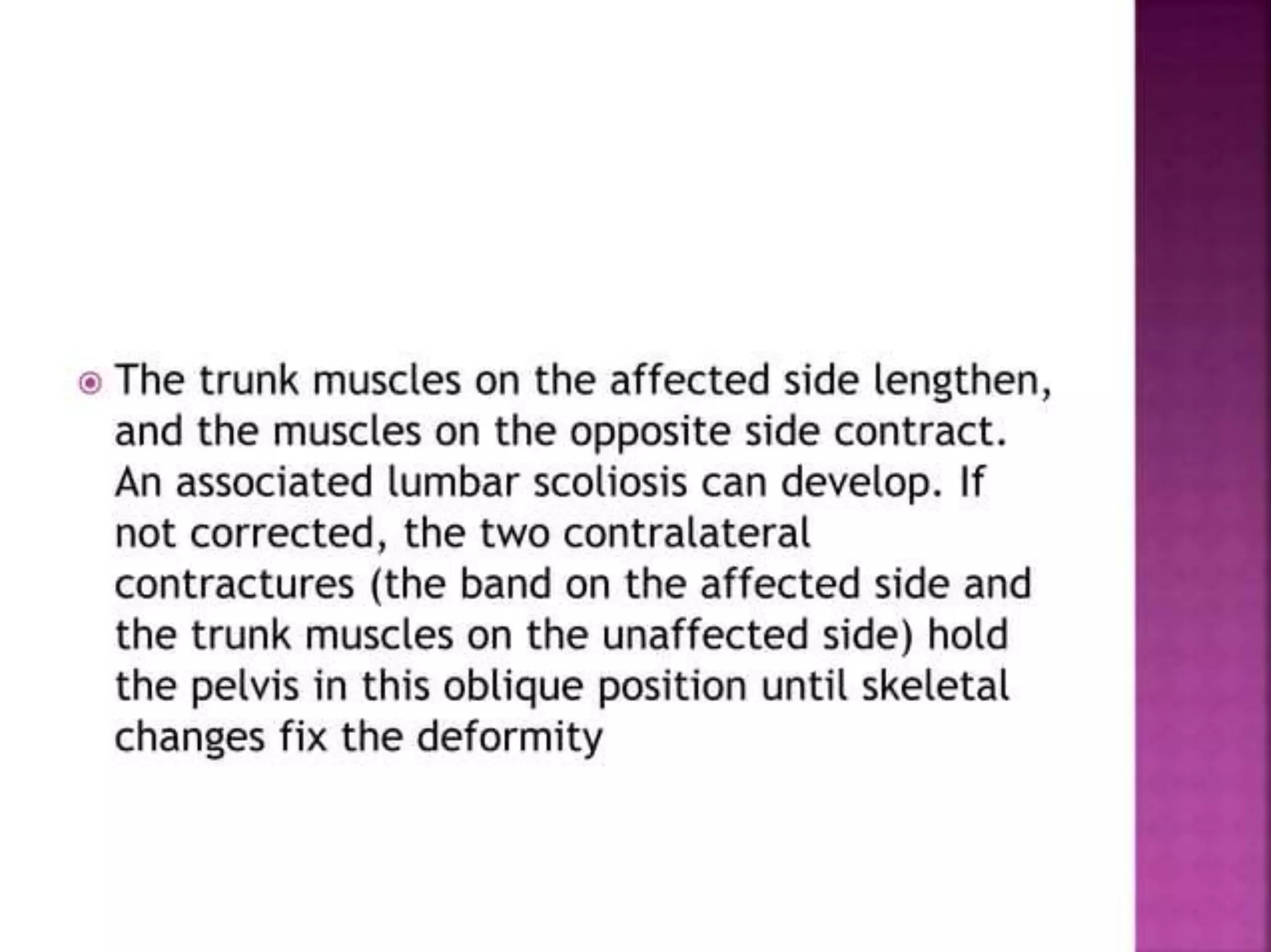post polio residual paralysis.pptx