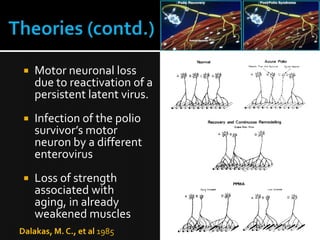 

Motor neuronal loss
due to reactivation of a
persistent latent virus.



Infection of the polio
survivor’s motor
neuron by a different
enterovirus



Loss of strength
associated with
aging, in already
weakened muscles

Dalakas, M. C., et al 1985

13

 